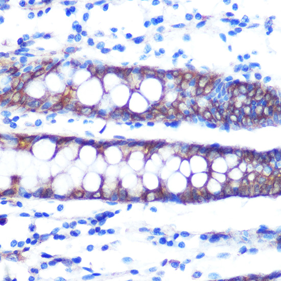 Anti-Occludin Antibody (CAB2601)