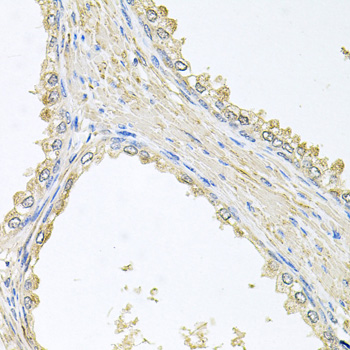 Anti-PMM2 Antibody (CAB4026)