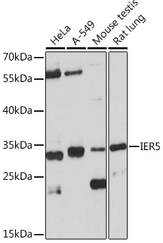 Anti-IER5 Antibody (CAB18457)