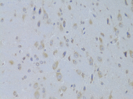 Anti-IGF2 Antibody (CAB14005)