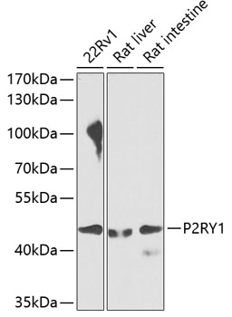 Anti-P2RY1 Antibody (CAB7706)