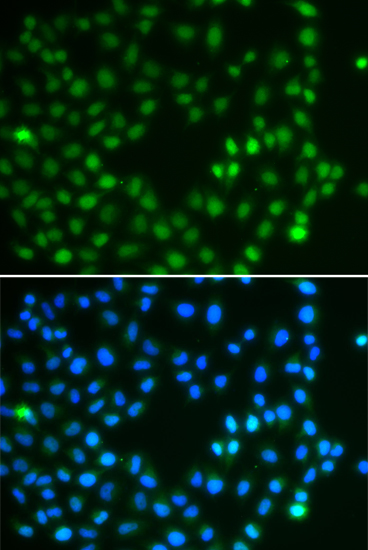 Anti-SALL4 Antibody (CAB7124)