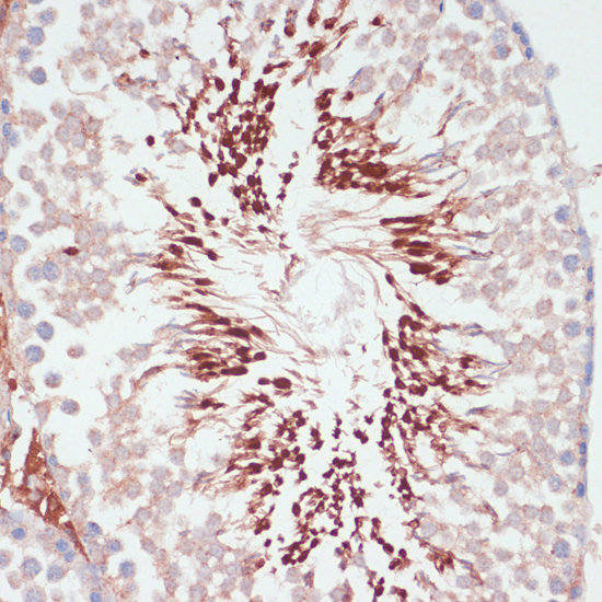 Anti-PGK2 Antibody (CAB12952)