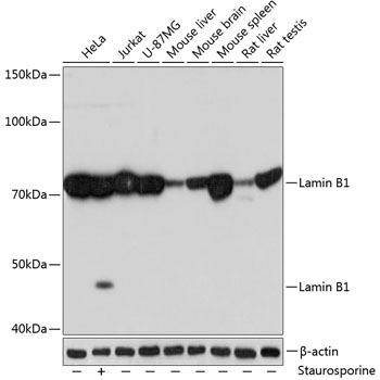 Anti-Lamin B1 Antibody