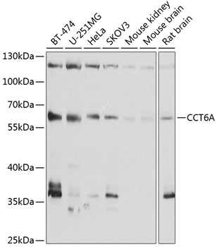 Anti-CCT6A Antibody (CAB3589)