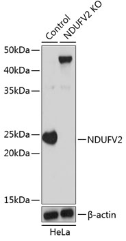 Anti-NDUFV2 Antibody [KO Validated] (CAB19936)