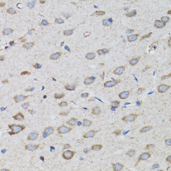 Anti-PSMD10 Antibody (CAB1949)