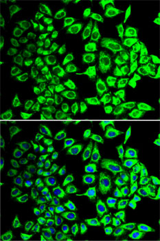 Anti-SDHA Antibody (CAB2594)