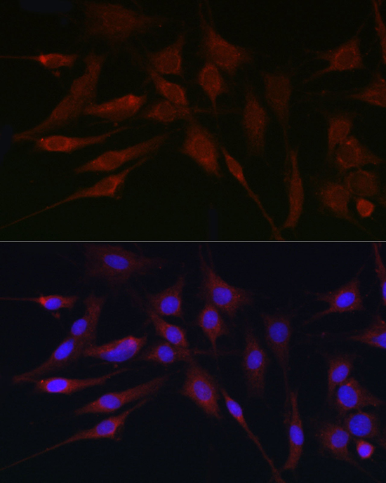 Anti-APOBEC3G Antibody (CAB13598)