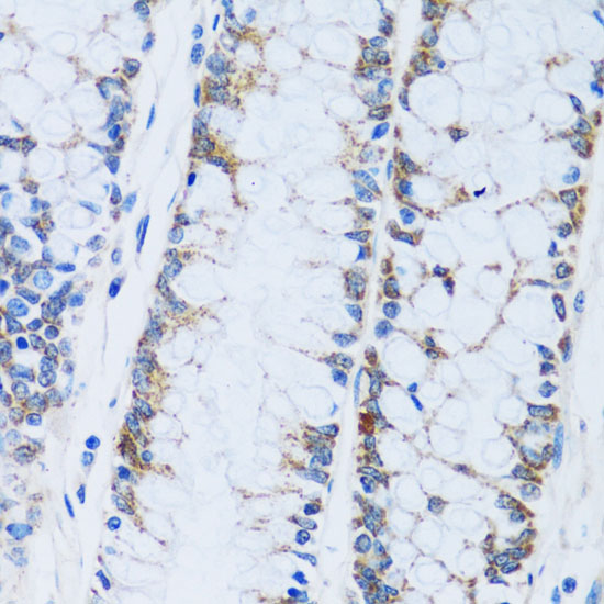 Anti-CA13 Antibody (CAB14467)