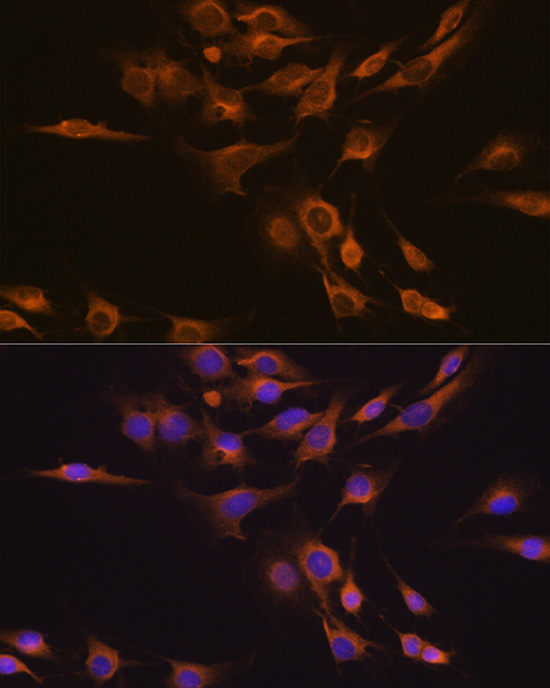 Anti-CNTF Antibody (CAB1915)