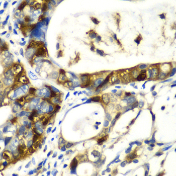 Anti-SNCA Antibody (CAB13354)