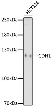 Anti-E-Cadherin Mouse Monoclonal Antibody (CAB18135)