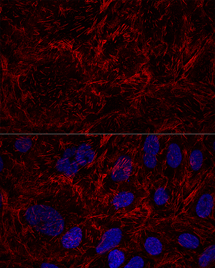 Anti-Septin-9 Polyclonal Antibody (CAB8657)