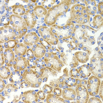 Anti-BMP15 Antibody (CAB7321)