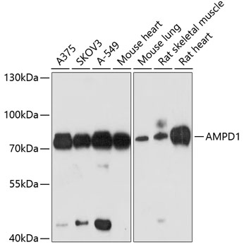 Anti-AMPD1 Antibody (CAB3584)