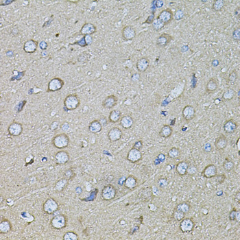 Anti-Osteopontin Antibody (CAB1499)