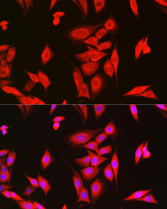 Immunofluorescence analysis of NIH/3T3 cells using CASTOR1 Rabbit pAb at dilution of 1:50 (40x lens). Blue: DAPI for nuclear staining.