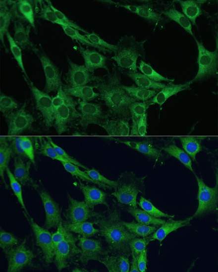 Anti-NF-kB p65 Antibody (CAB2547)