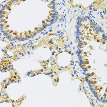 Anti-HRG Polyclonal Antibody (CAB8431)