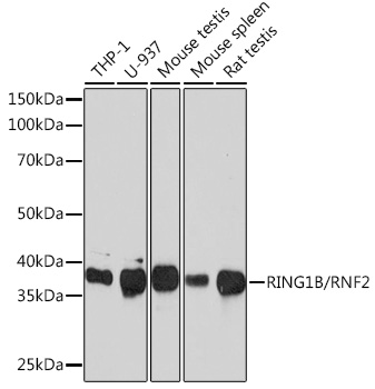 Anti-RING1B/RNF2 Antibody (CAB3564)