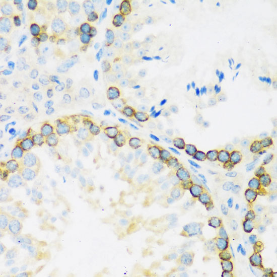 Anti-FMR1 Antibody (CAB6092)