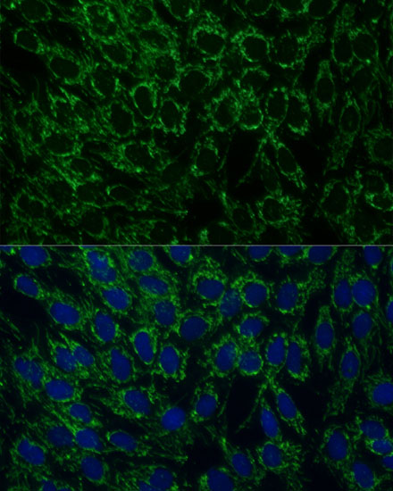 Anti-MTIF2 Antibody (CAB16402)