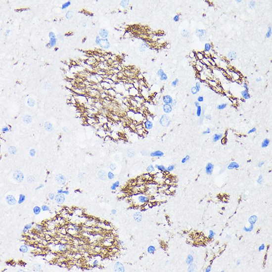 Anti-APP Rabbit Monoclonal Antibody [KO Validated] (CAB17911)