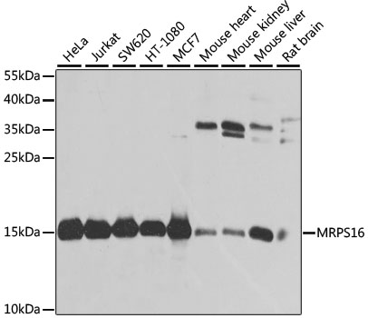 Anti-MRPS16 Polyclonal Antibody (CAB9874)