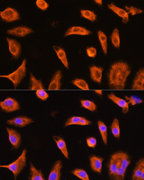 Anti-GSTP1 Antibody (CAB5691)