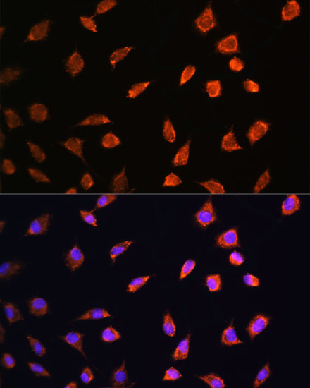 Anti-ART1 Antibody (CAB10103)