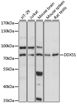 Anti-DDX51 Antibody (CAB15580)