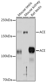 Anti-ACE Antibody (CAB2805)