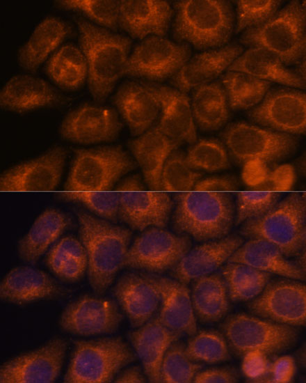 Anti-SEC23IP Antibody (CAB15398)