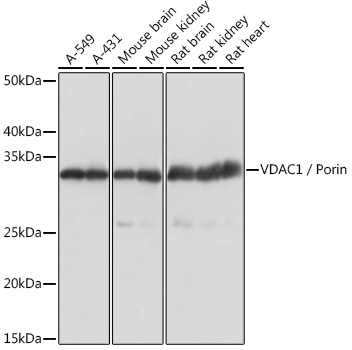 Anti-VDAC1 / Porin Antibody (CAB0810)