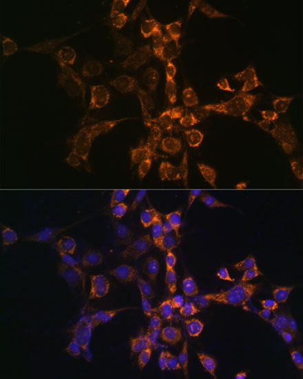 Anti-SEPT4 Antibody (CAB10238)