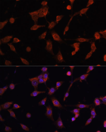 Anti-LAMP1 Antibody (CAB11468)