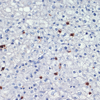 Anti-S100A8 Antibody (CAB15315)