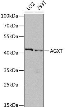 Anti-AGXT Polyclonal Antibody (CAB8397)