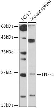 Western blot analysis of extracts of various cell lines, using TNF-ÃŽÂ± antibody at 1:1000 dilution. Secondary antibody: HRP Goat Anti-Rabbit IgG (H+L) at 1:10000 dilution. Lysates/proteins: 25ug per lane. Blocking buffer: 3% nonfat dry milk in TBST. Detection: ECL Basic Kit. Exposure time: 30s.