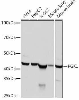 Anti-PGK1 Antibody