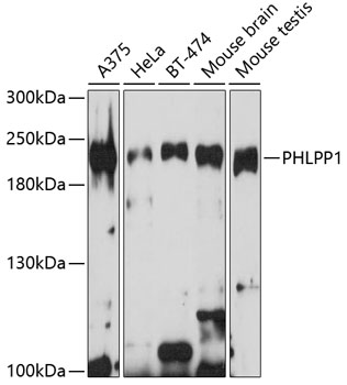 Anti-PHLPP1 Polyclonal Antibody (CAB9542)