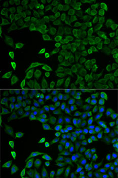 Anti-SLC25A13 Antibody (CAB12557)