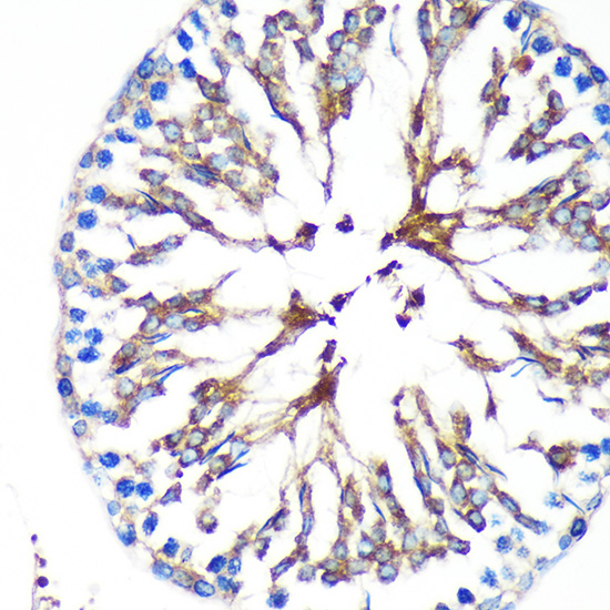 Anti-KIF17 Antibody (CAB16562)