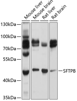 Anti-SFTPB Antibody (CAB1748)