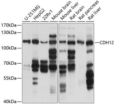 Anti-CDH12 Antibody (CAB10206)