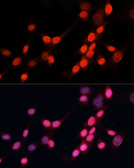 Anti-ERCC5 Antibody (CAB1605)