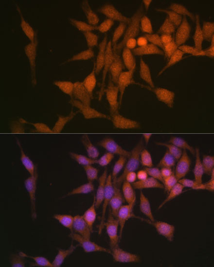 Anti-PSMB6 Antibody (CAB4053)