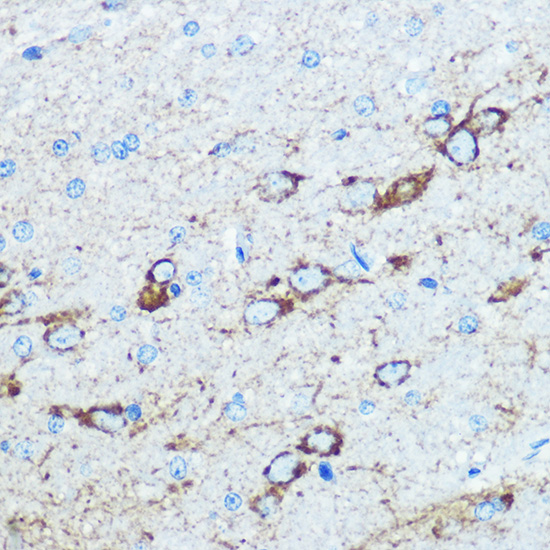 Anti-GRIN1 Antibody (CAB7677)