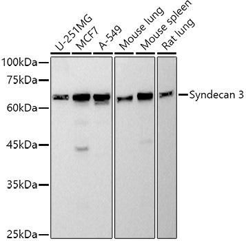 Western blot analysis of extracts of various cell lines, using Syndecan 3 antibody at 1:500 dilution. Secondary antibody: HRP Goat Anti-Rabbit IgG (H+L) at 1:10000 dilution. Lysates/proteins: 25ug per lane. Blocking buffer: 3% nonfat dry milk in TBST. Detection: ECL Basic Kit. Exposure time: 30s.